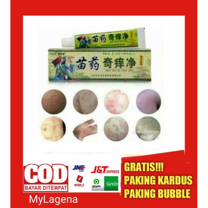 SALEP JAMUR SELANGKANGAN AMPUH OBAT JAMUR SELANGKANGAN AMPUH