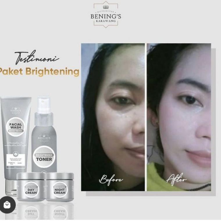 HOT ITEM 8922 Paket Brightening shale 25% Skincare (Kulit Normal) Bening's skincare By dr.Oky Pratam