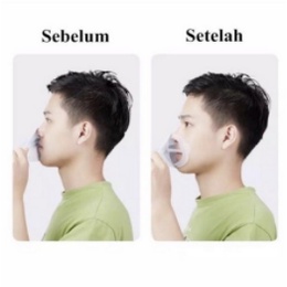 Mediocare Penyangga Masker ( 3D Masker Bracket )