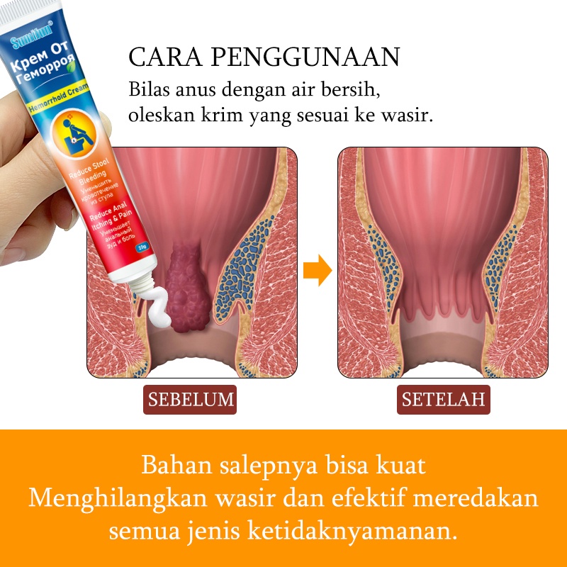 Obat wasir Salep wasir Krim wasir 20G Obat herbal alami, aman dan tidak berbahaya, cepat dan efektif menghilangkan wasir, menghilangkan benjolan, wasir dalam, wasir luar, wasir campuran, gatal pada anus, luka pada lubang anus