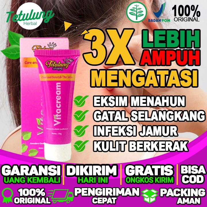 Obat Cream Untuk Gatal Di Selangkangan Krim Untuk Menghilangkan Gatal Di leher Dan Eksim Menahun