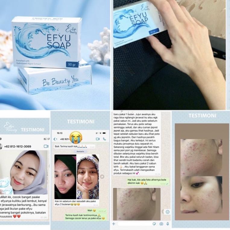 ㅵ Efyu algae bar soap - Sabun jerawat dan mencerahkan ♚