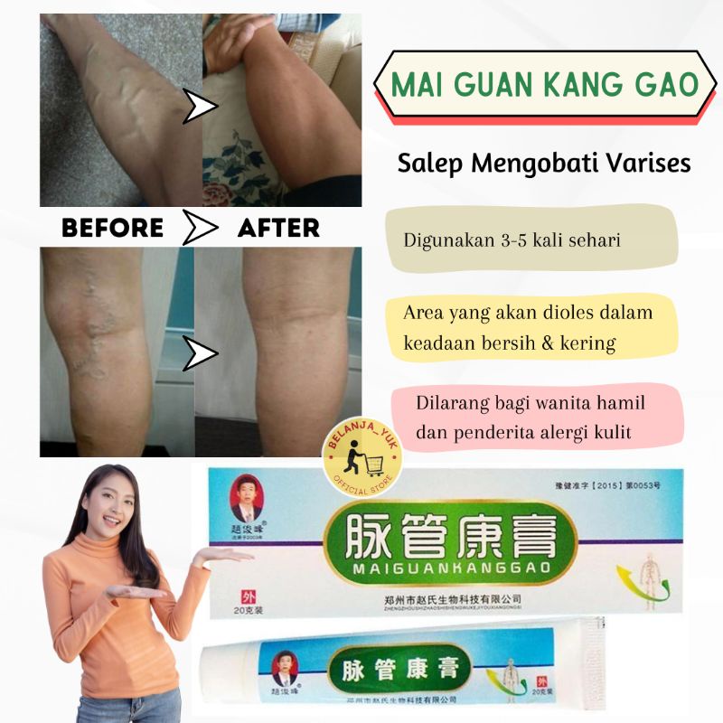 Mai Guan Kang Gao Salep Mengobati Varises / Maiguankanggao Krim Obat Varises Kaki / Krim Penghilang Varises Kaki / Obat Cina Herbal Untuk Varises Kaki / Krim Salep China Untuk Pengobatan Varises Kaki / Salep Varises Ampuh / Varicose Veins Treatment Cream