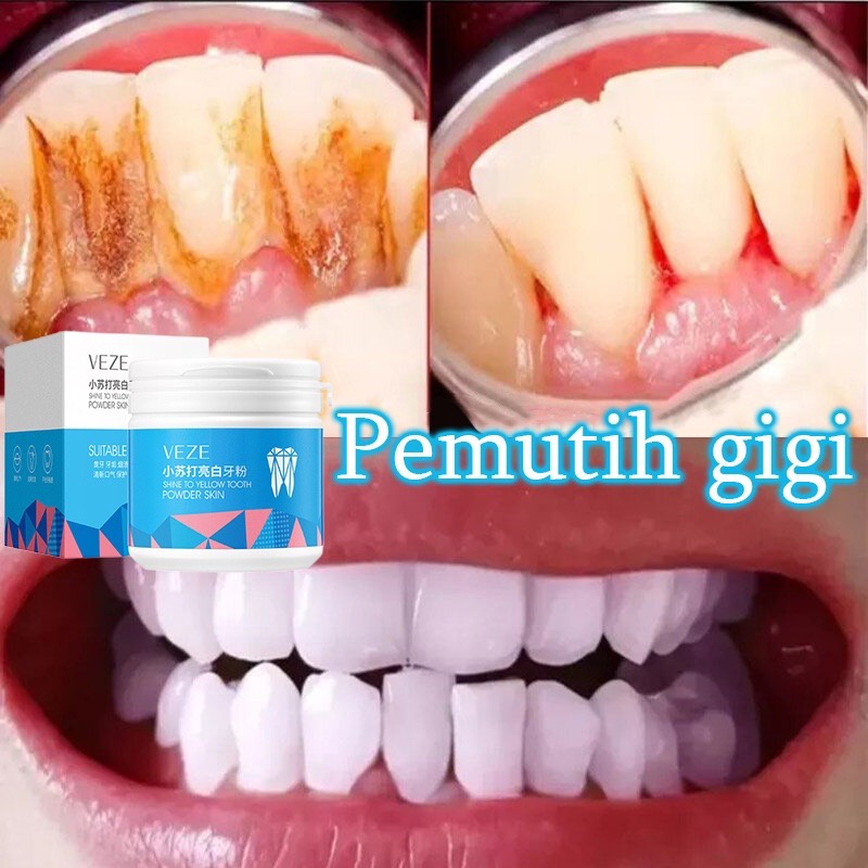 [BPOM] - Pemutih Gigi Veze Serbuk Gigishine Yellow Tooth Powder Skin