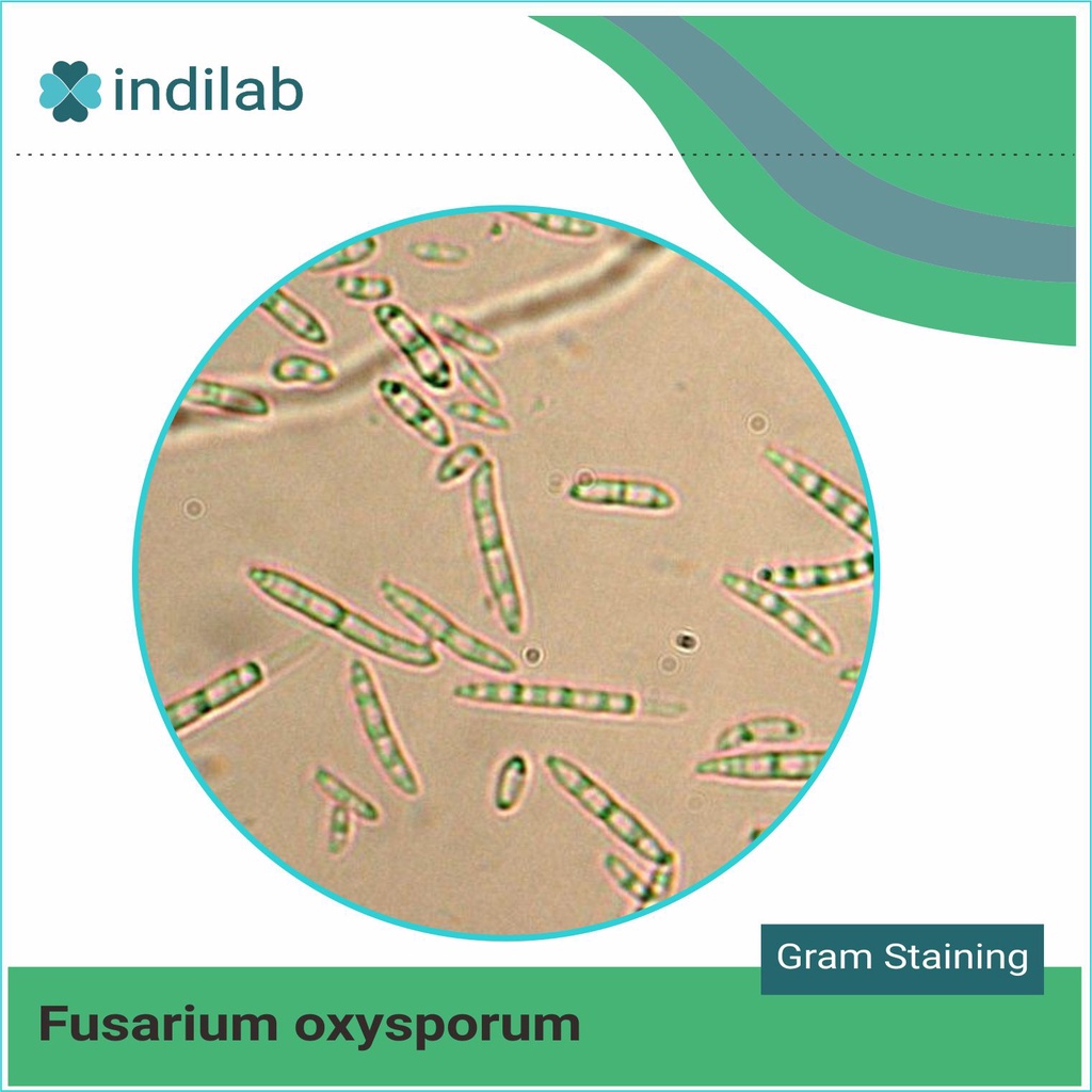 Kultur isolat jamur Fusarium oxysporum