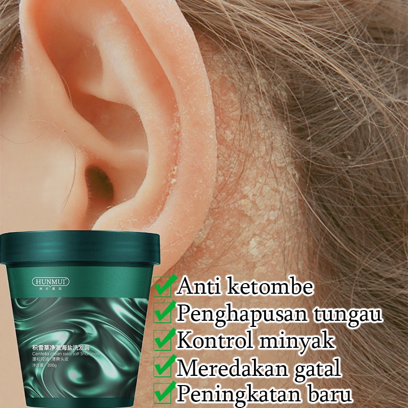 Anti-dandruff shampoo Sampo anti ketombe Shampo anti rontok Shampoo kutu rambut Sangat menutrisi rambut Mengurangi ujung bercabang Sterilisasi yang efisien dan anti ketombe