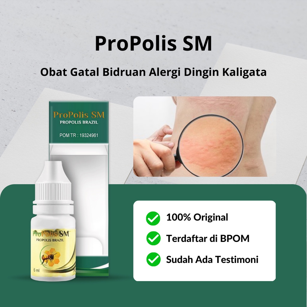 Jual Propolis SM - Obat Biduran Alergi Dingin Gatal Kulit Bentol Bentol ...