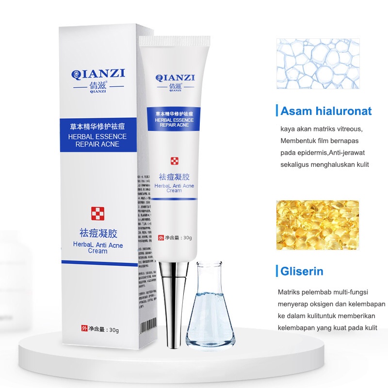cream jerawat krim jerawat Acne treatment Cream  jerawat Obat jerawat Penghilang bekas 30g jerawat Memudarkan jerawat Serum acne Krim jerawat Krim penghilang jerawat