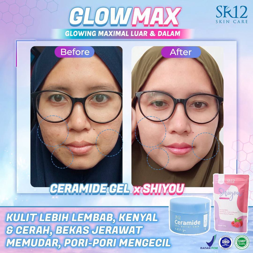 Ceramide SR12 Skin Barrier Repair Moisturizer Serum Cream Pemutih Pelembab Wajah Day Night Ori BPOM