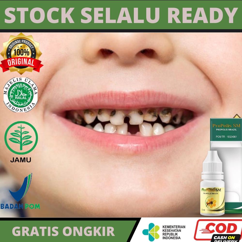 Obat Gigi Hitam Pada anak & Dewasa, Gigi keropos, Gigi berlubang/Karies, Obat Gigi rusak, Gigi berda