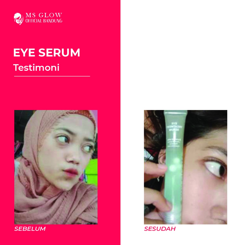 Eye Serum MS Glow / Penghilang Mata Panda Berkualitas Termurah By Msglowofficialbandung