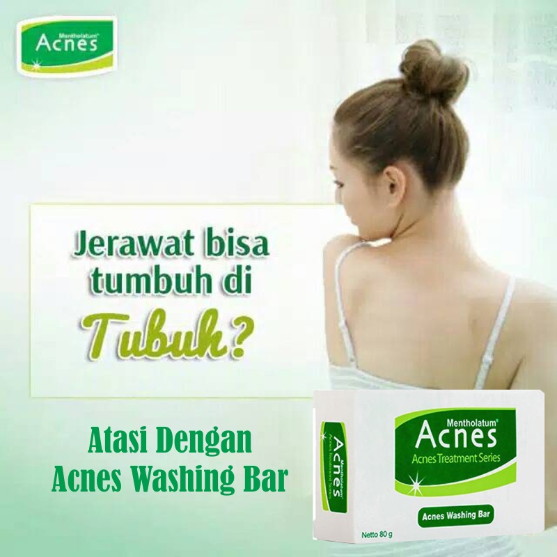 Sabun Mandi Untuk Jerawat Punggung Sabun Cuci Muka Acnes Washing Bar 80gr Pembersih Jerawat Obat Pen