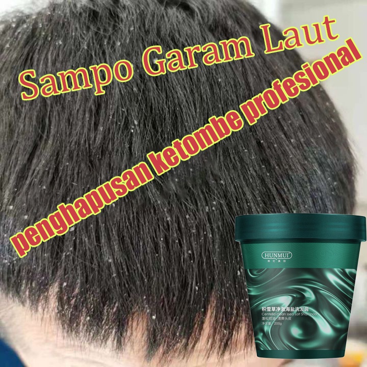 Jual Centella Sampo Anti Ketombe 99 Garam Laut Anti Ketombe Yang Ampuh Shampoo Anti Ketombe Dan 7466