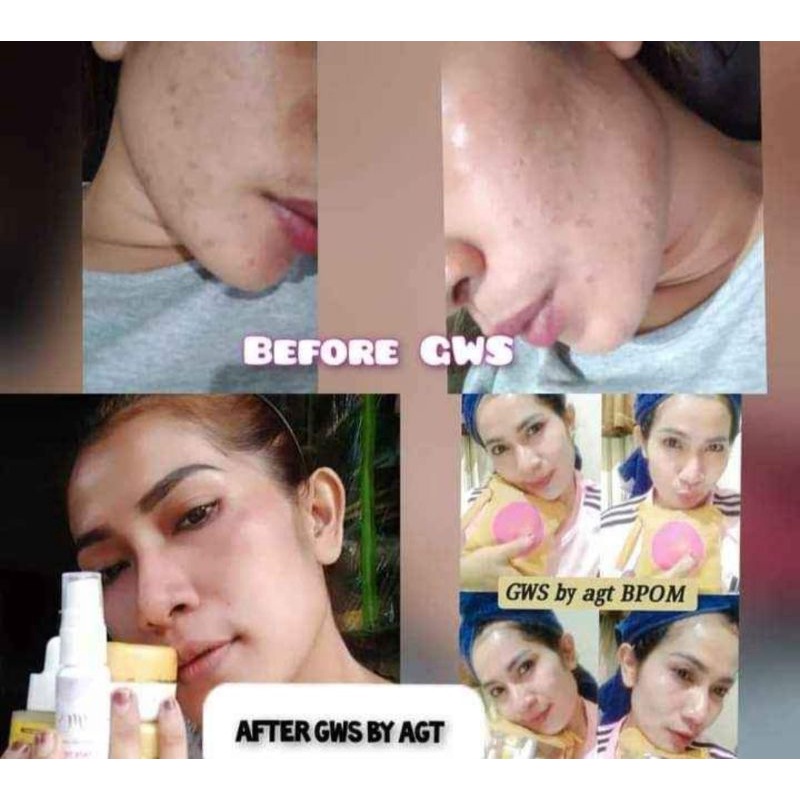 GWS skincare BPOM(aman busui bumil,glowing sketika flek kusam bebas jerawat)