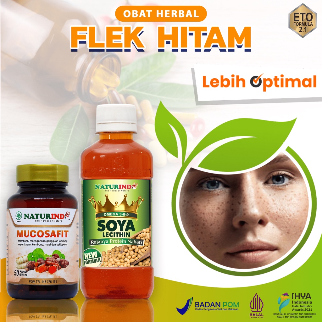 obat flek hitam diwajah bintik hitam diwajah herbal ampuh naturindo herbal
