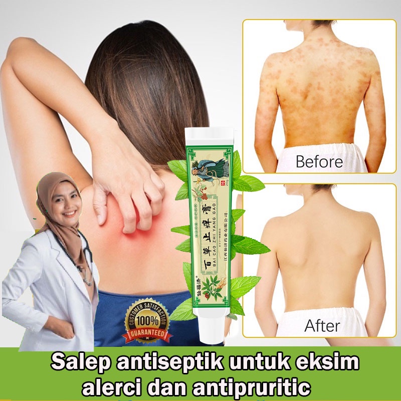 [COD ] Salep Baicao anti pruritus, salep anti pruritus, gigitan nyamuk serangga, menghilangkan bengk