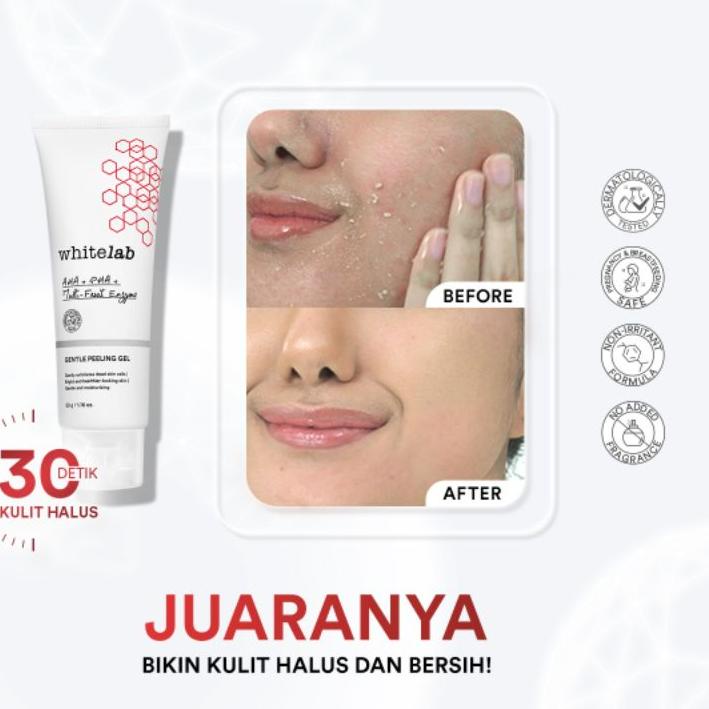 Jual Klik Beli Whitelab Gentle Peeling Gel Gel Pengangkat Sel Kulit