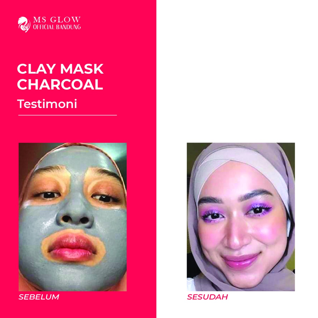 MS Glow Clay Mask Charcoal Masker Wajah Kusam &amp; Pori Pori Besar - By MsGlowofficialbandung