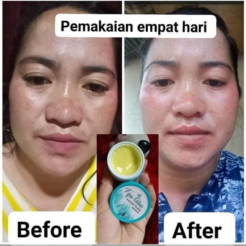SALEP FLEK FIFAB GLOW BY. RF