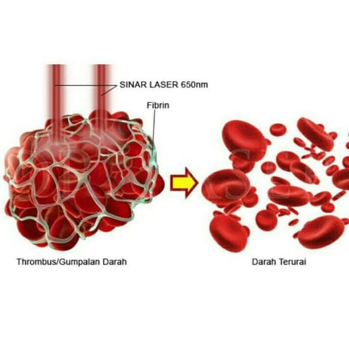 jam laser kesehatan 12 & 7 titik dr terapi laser hipertensi stroke dll