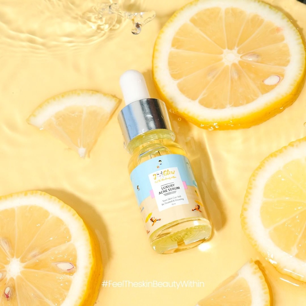 SERUM LUXURY ACNE BABY/SERUM JERAWAT REMAJA/Serum baby j glow - serum baby acne