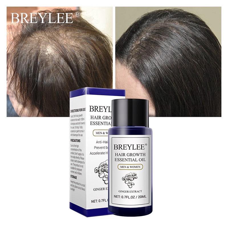 Breylee Hair Growth Essential Oil Penumbuh Rambut Cepat 20mL