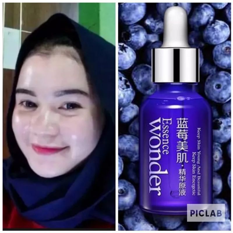 SERUM PEMUTIH WAJAH EXTRA CEPAT SEUM PENGHILANG FLEK MEMBANDEL