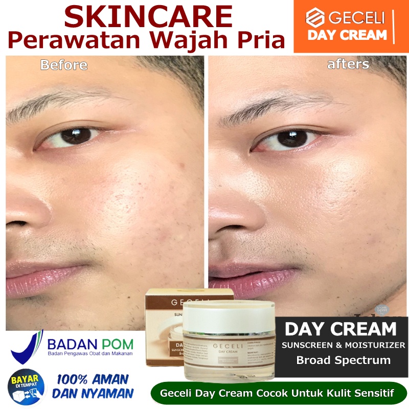Cream Penghilang Jerawat & Bruntusan | Obat Krim Salep Jerawat-Penghilang Jerawat Pria AMPUH Krim Je