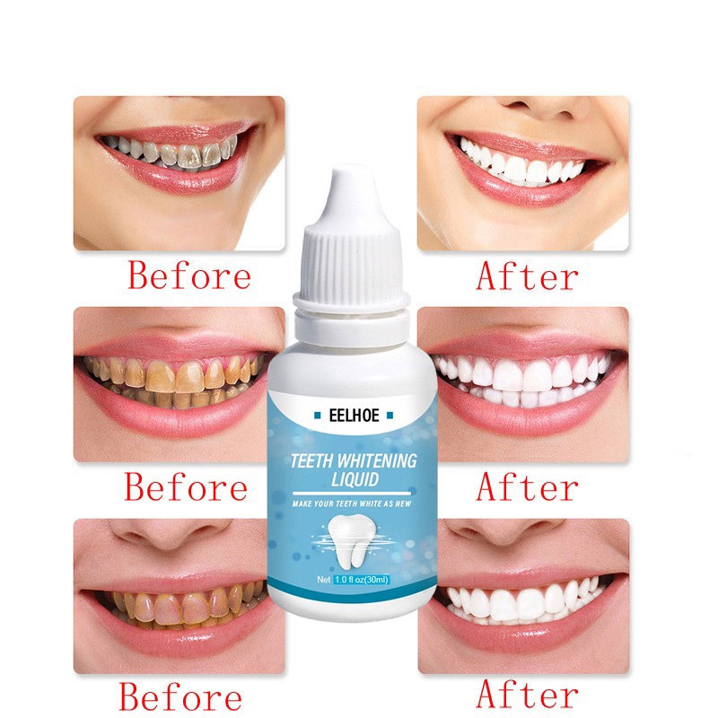 Pemutih Gigi Kuning Whitening teeth Bleaching tooth cairan pembersih gigi berbehel &amp; tidak - Alat bahan Penghilang Pembersih plak karang gigi ampuh