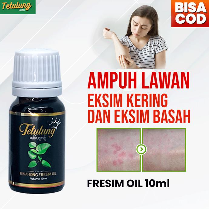 Binahong Fresim Oil 10ml - Obat Gatal Kulit Eksim Kering Paling Ampuh