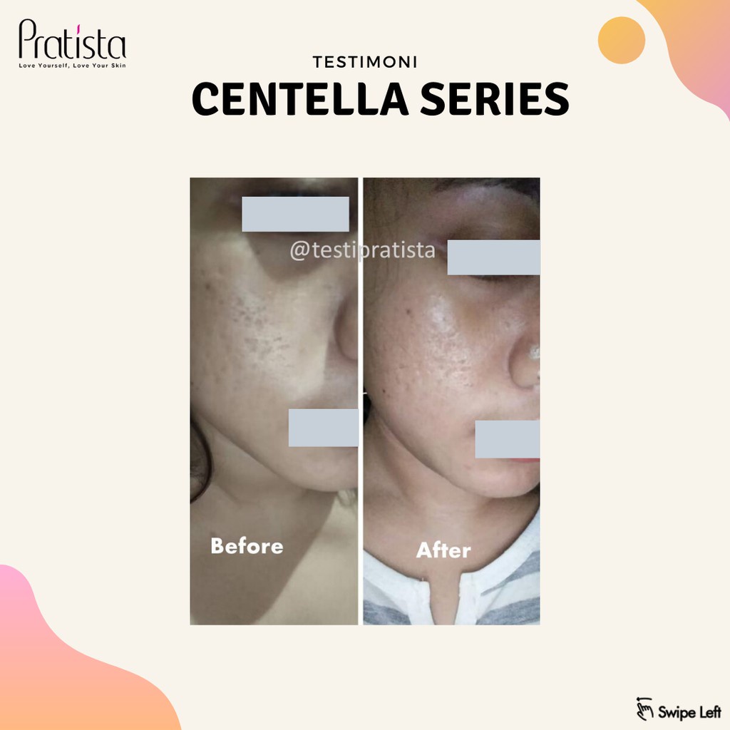 Pratista Cream Bopeng Wajah CENTELLA ENRICH CREAM Pratista Skincare Krim Lubang Bekas Jerawat dan Cacar BPOM