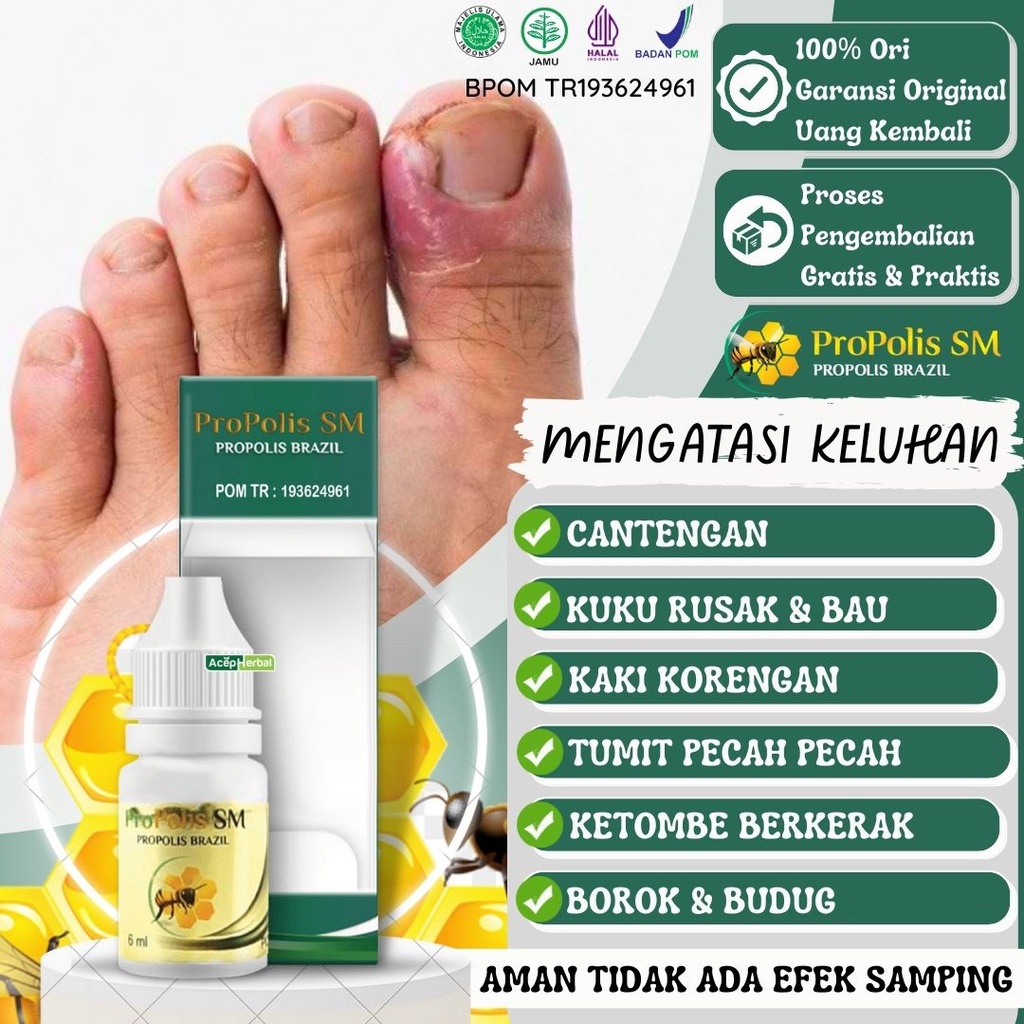 Jual Obat Tetes Cantengan Kuku Kaki Rusak Jamuran Bernanah Bau Kaki