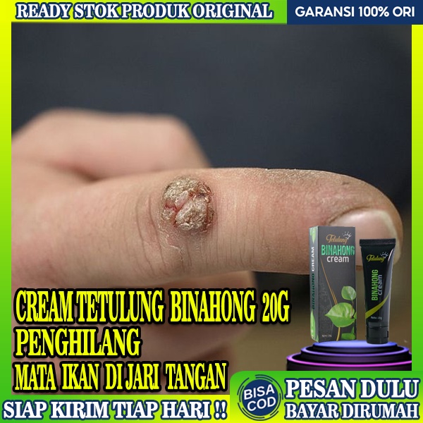 Jual Obat Mata Ikan Di Jari Tangan,Tetulung Cream Binahong 20g,Obat