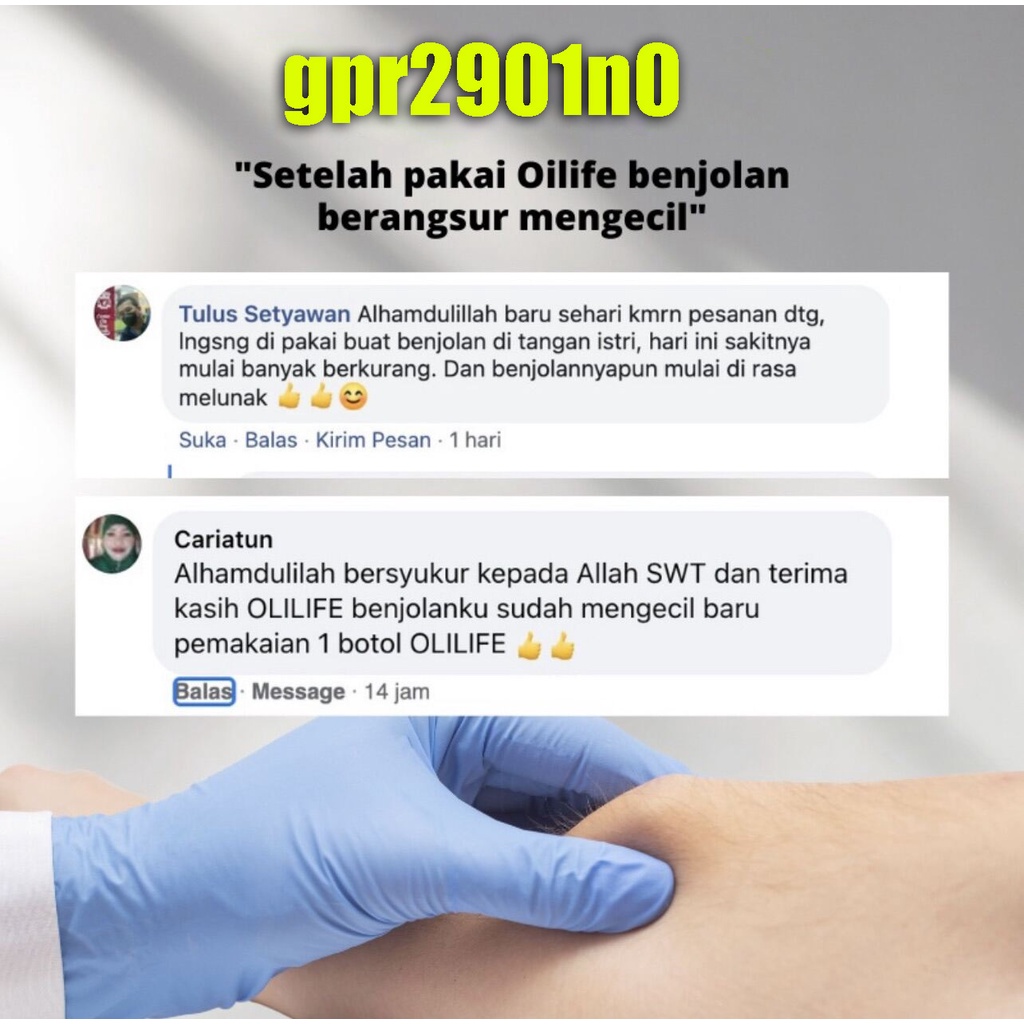 Obat Benjolan Lipoma Obat herbal Cina Krim lipoma 30g Perawatan punggung/leher/paha Kanker Tumor Kelenjar Tiroid Lipoma