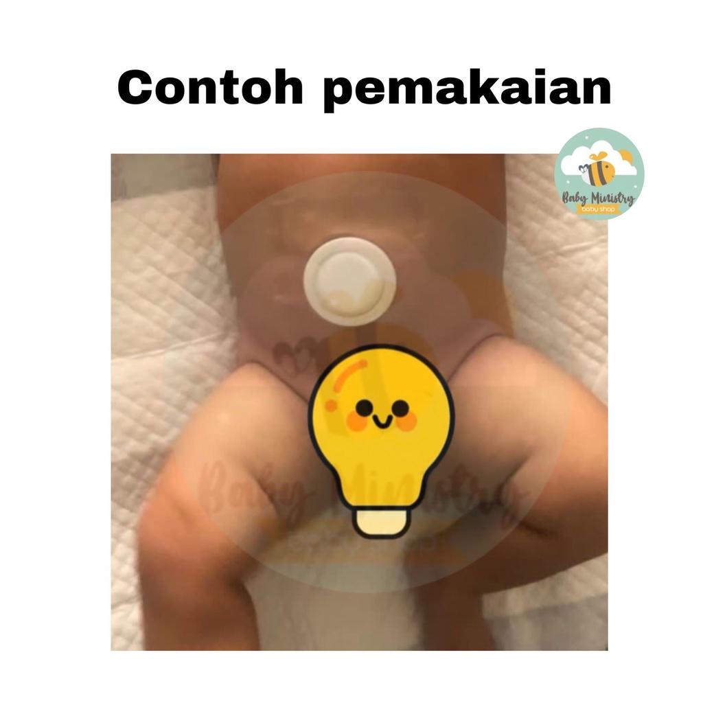 KOYO HERBAL HERNIA ANAK PATCH / SABUK HERNIA/ PUSAR BODONG / HERNIA / MANJUR / BEST SELLER