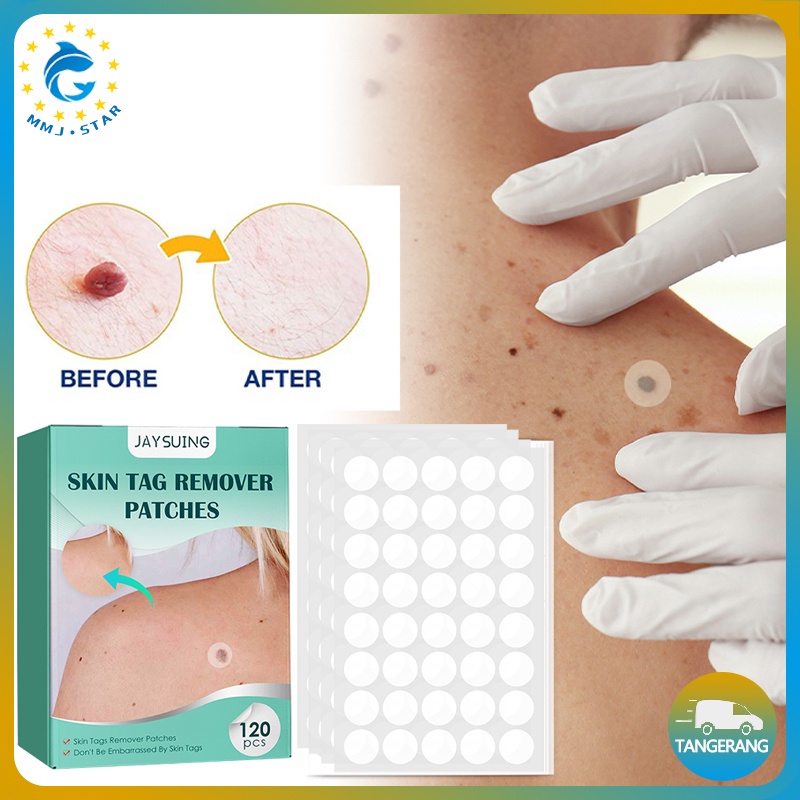 【120 PCS】Patch Menghilangkan Kutil Tahi Lalat/Stiker Plester Penghilang Kutil/Patch Wart Removal/Skin Tag Remover Patch