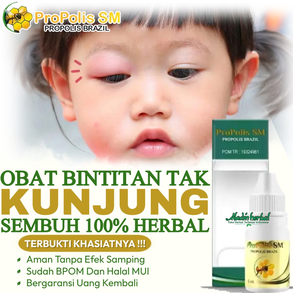 jual-obat-bintitan-tak-kunjung-sembuh-obat-mata-bintitan-atau