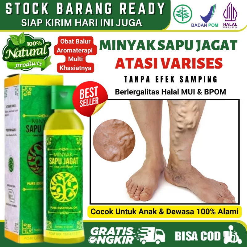 Minyak Balur Varises 100% Herbal, Obat Varises di Betis Telapak Tangan Kaki Perut Kelamin Testis Bua