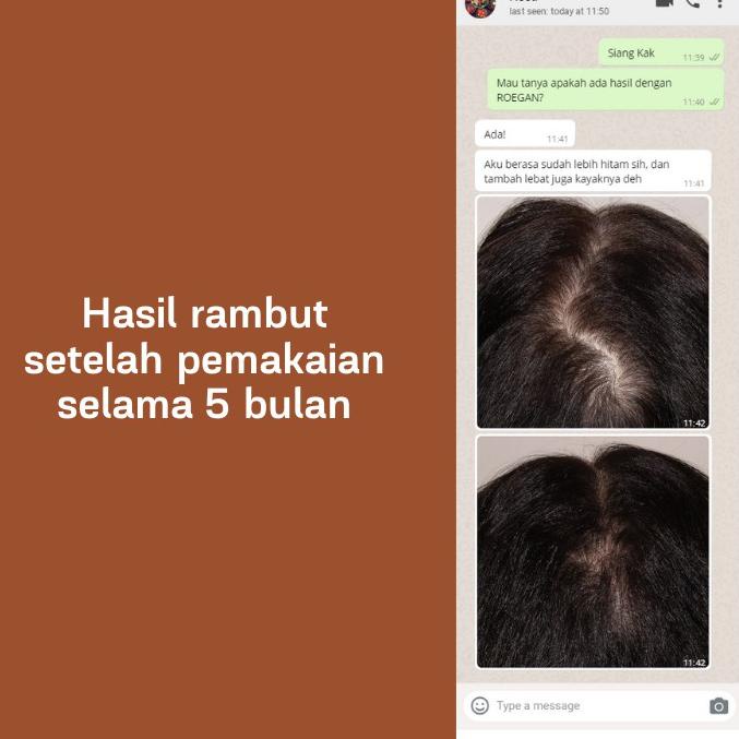 ❁Ready ROEGAN Minyak Kemiri - Penumbuh Rambut Penghitam Uban Alami 84