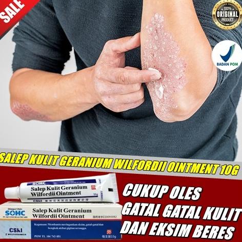 salep exim kering obat gatal salep kulit salep kulit geranium 10 gram