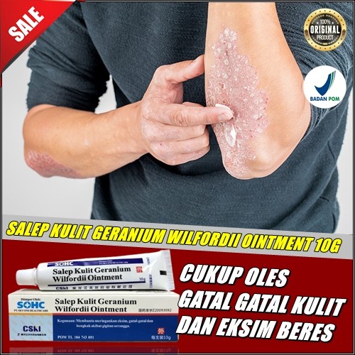 Salep Kulit Geranium Original 100% Salep Gatal-gatal Eksim kurap kudis ampuh