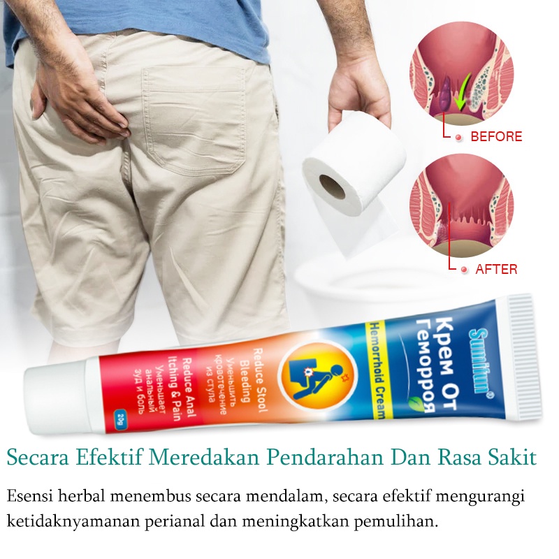 Obat wasir Salep wasir Krim wasir 20G Obat herbal alami, aman dan tidak berbahaya, cepat dan efektif menghilangkan wasir, menghilangkan benjolan, wasir dalam, wasir luar, wasir campuran, gatal pada anus, luka pada lubang anus