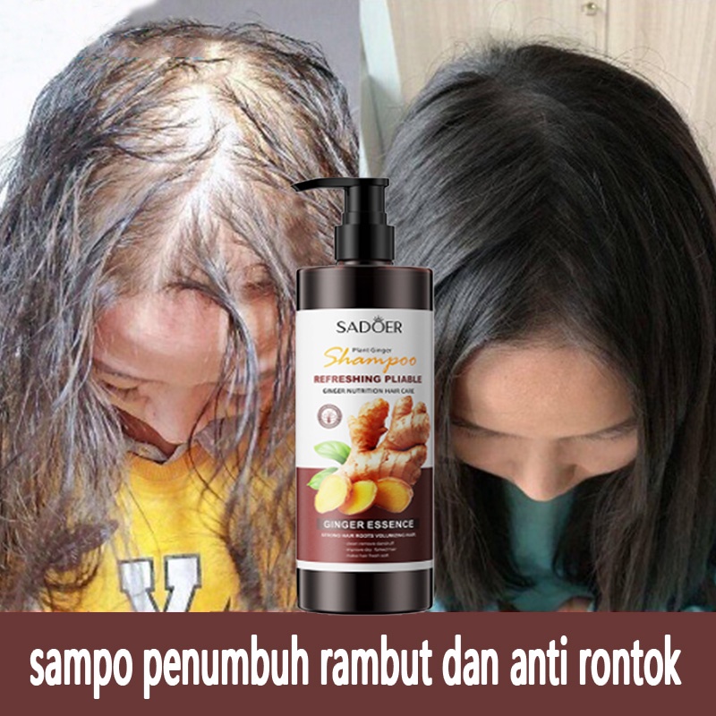 Perangi Ketombe dan Gatal: 12 Rekomendasi Shampoo untuk Kulit Kepala Sehat