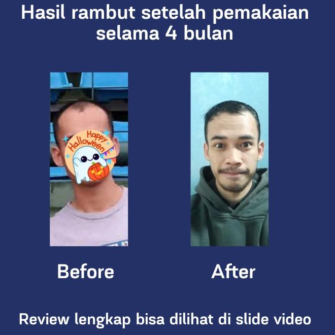 Big Sale W8SJE ROEGAN Minoxidil 5% - Penumbuh Rambut Brewok (untuk Botak & Rontok) Z79 Ready Stock