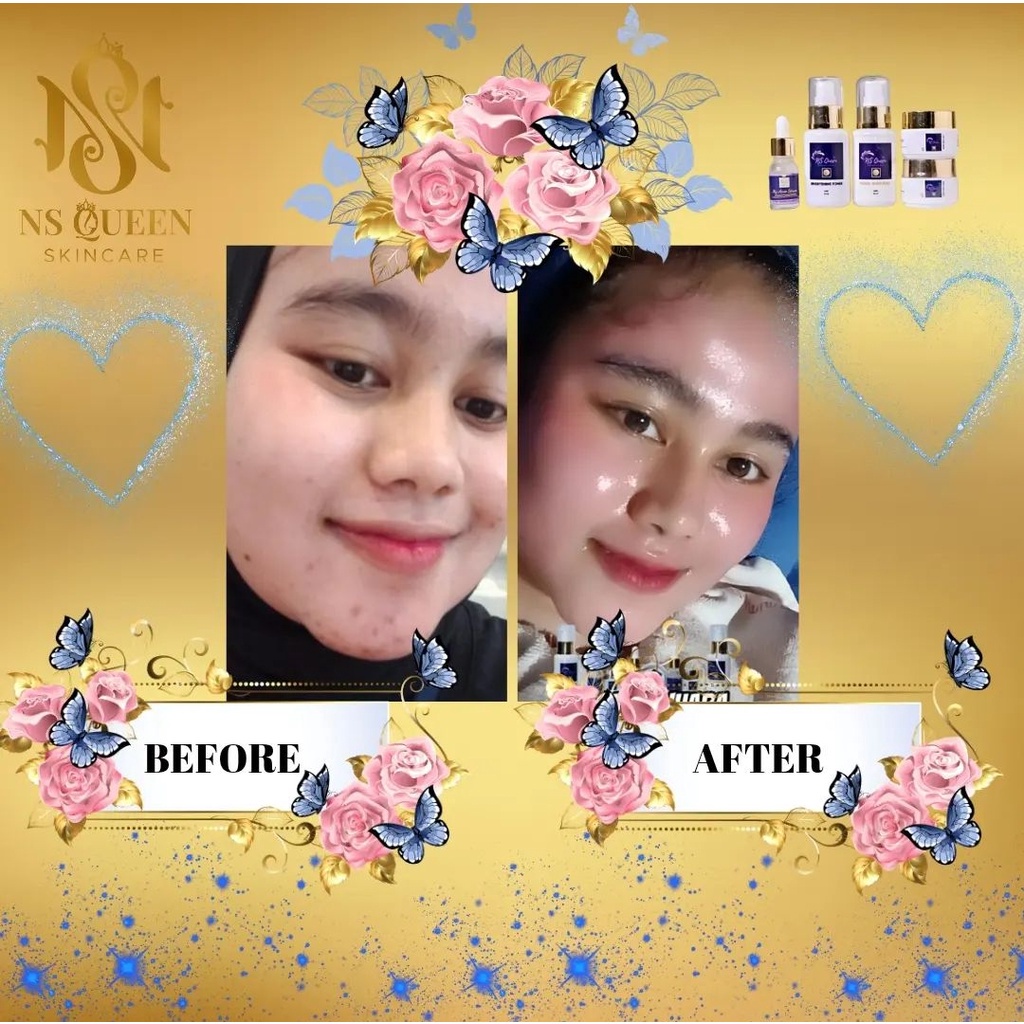 NS Queen Skincare BPOM Original Skincare Bermutu NS Queen Skincare