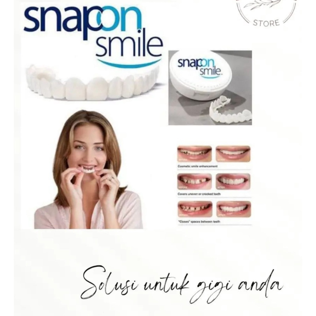 SNAP ON SMILE