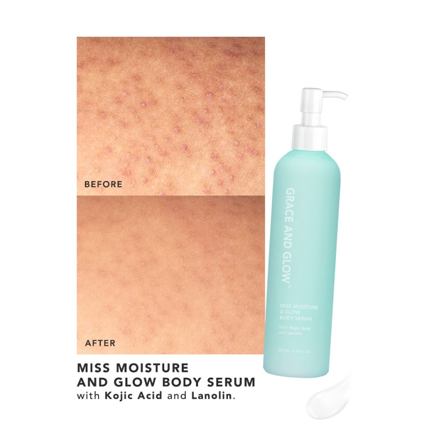 Serum Pelembab Kulit Kering Grace and Glow Miss Moisture &amp; Glow Body Serum 300 ml for Chicken Skin