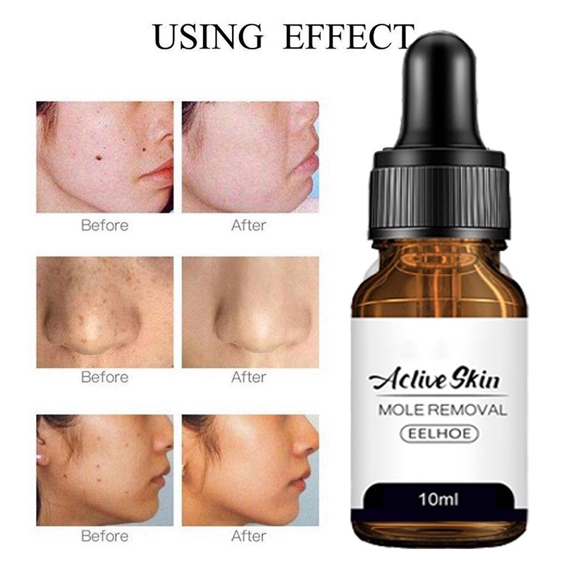 obat penghilang tahi lalat ampuh original obat kutil kelamin penghilang tahi lalat di wajah obat kut