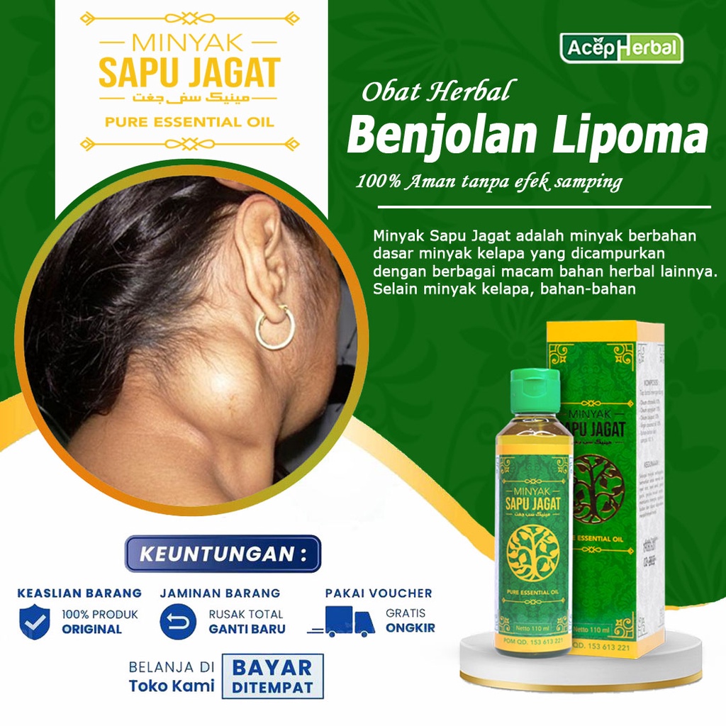 Jual Obat Oles Benjolan Di Leher Tangan Payudara Ketiak Belakang ...