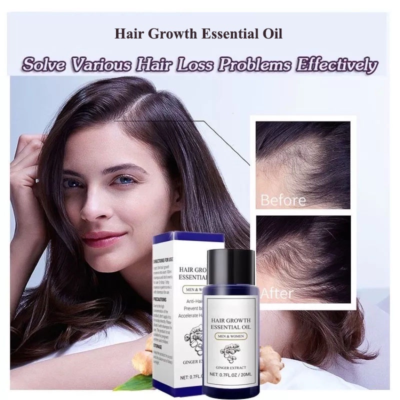 SHINE STAR - [ ORIGINAL 100% ] LANBENA HAIR GROWTH ESSENTIAL OIL / SERUM PENUMBUH RAMBUT BOTAK &amp; MENCEGAH KERONTOKKAN